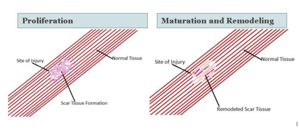 Early protected activity