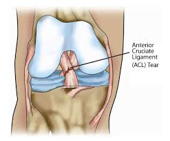 softball knee injury