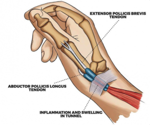 tendons in your thumb